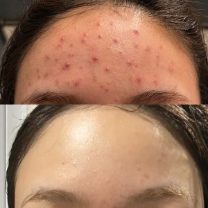 Lily フェイシャル ピーリング whitening カウンセリング サロン内装