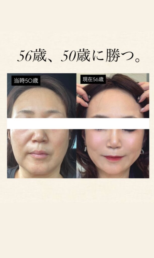 美容はとにかく【継続】が大切です✨