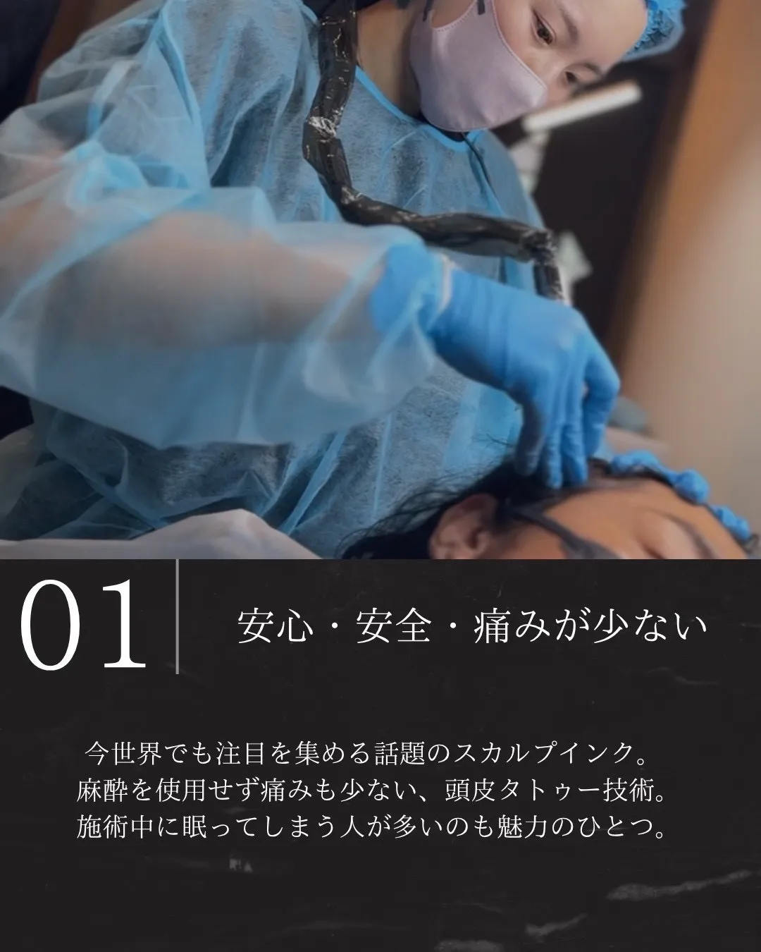 スカルプインクが選ばれる理由1|麻酔なしで痛みが少ない頭皮への色素施術技術