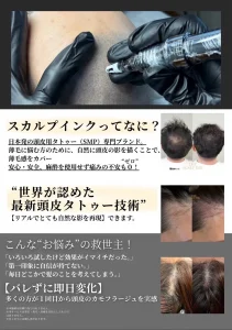 Beauty Salon Lilyのスカルプインク施術前後の頭頂部と生え際。薄毛の悩みをカバーする頭皮タトゥー