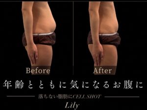 Beauty Salon Lilyの施術Before/After。横向きの女性のお腹周りが引き締まった様子