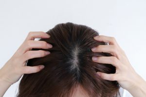Beauty Salon Lilyの女性が頭頂部の地肌を見せるスカルプケアの様子