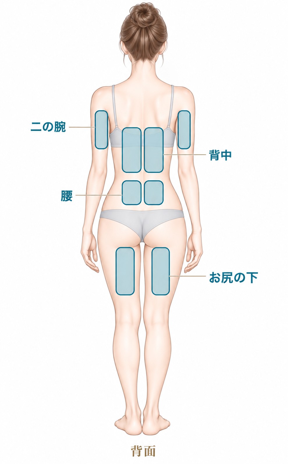 脂肪冷却の対応部位(背面)二の腕・背中・腰・お尻の下
